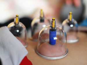 قیمت ساکشن حجامت