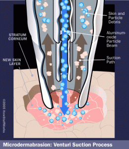 دستگاه ساکشن صورت