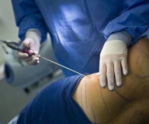 خرید دستگاه پال