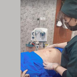 دستگاه ساکشن لاغری