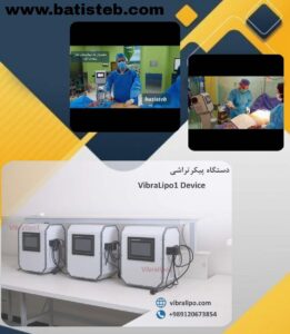 قیمت دستگاه لیپوساکشن